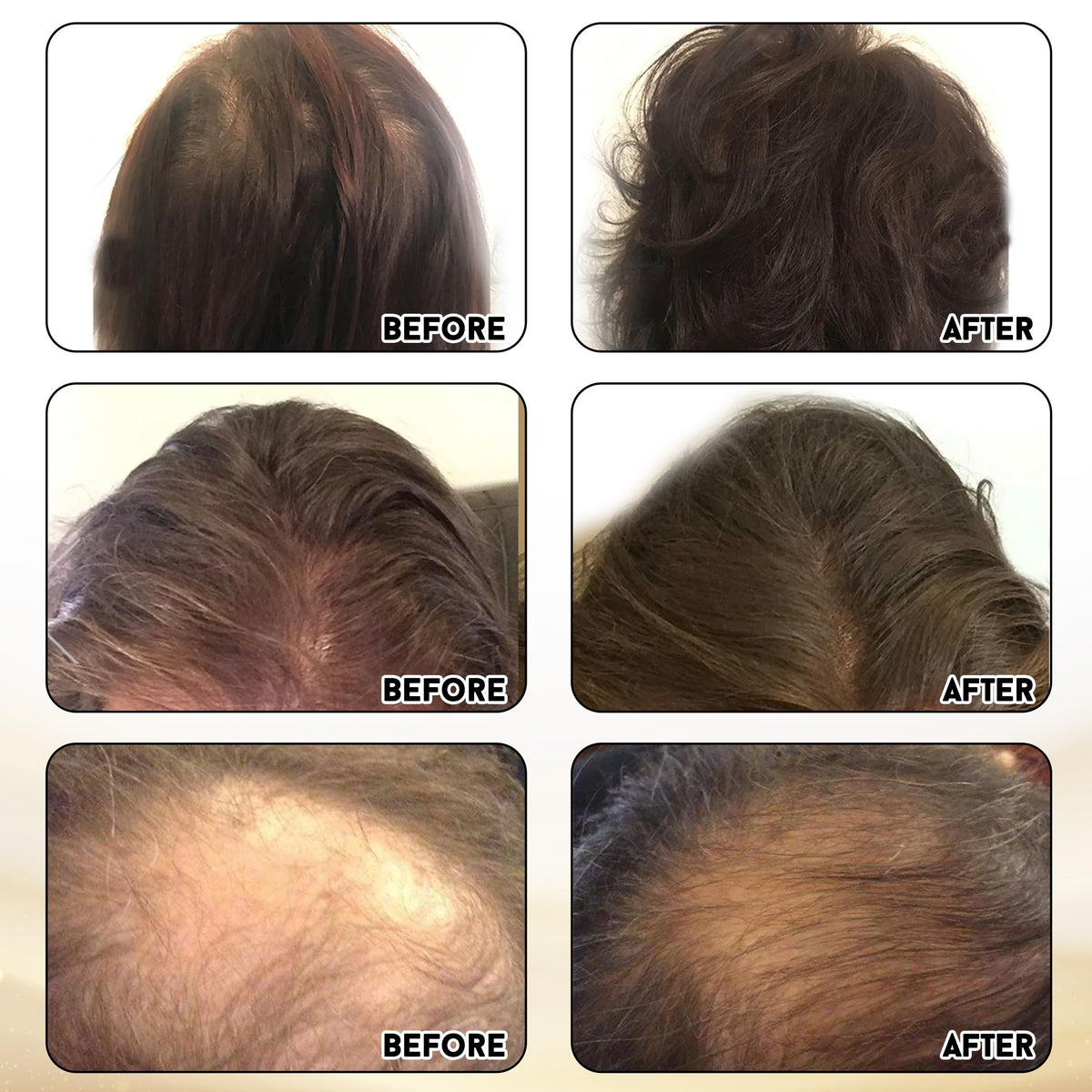 Miracle Elixir Collection Pure4 Oils panel highlights vitamins, antioxidants, and fatty acids.