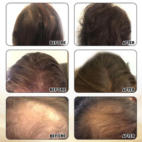 Miracle Elixir Collection Pure4 Oils panel highlights vitamins, antioxidants, and fatty acids.
