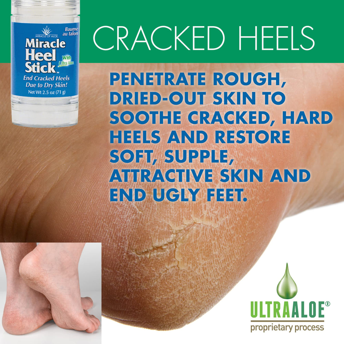 Close-up of Miracle of Aloe heel stick texture for fast absorption.