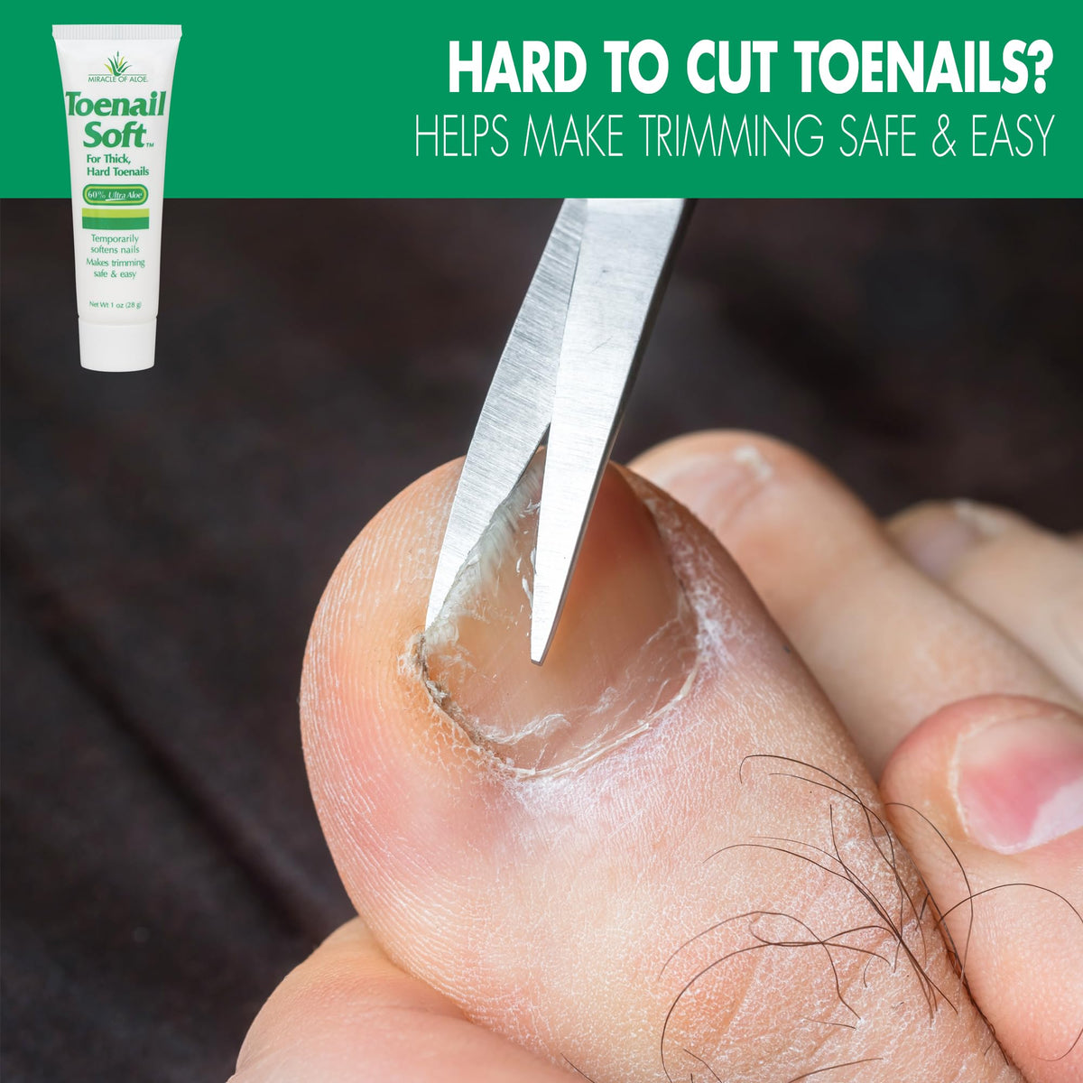 Miracle of Aloe toenail softener cream texture closeup showing creamy, non-greasy formula