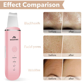 MISERWE Ion- mode in pink provides ion assisted cleansing