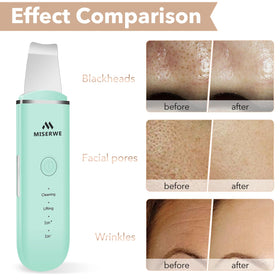 USB charging cord for MISERWE skin scrubber on the go
