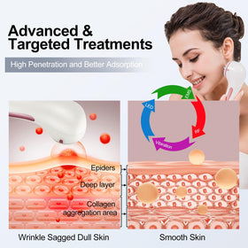 MiSMON rechargeable handheld design for portable at-home skincare.