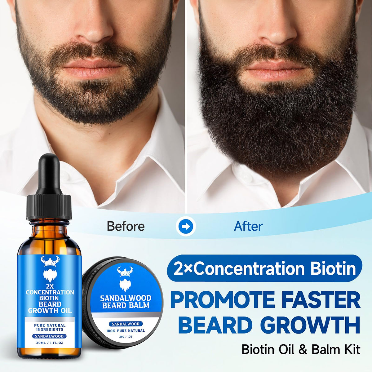 Deluxe MistySprite beard care kit ready for daily grooming routine.
