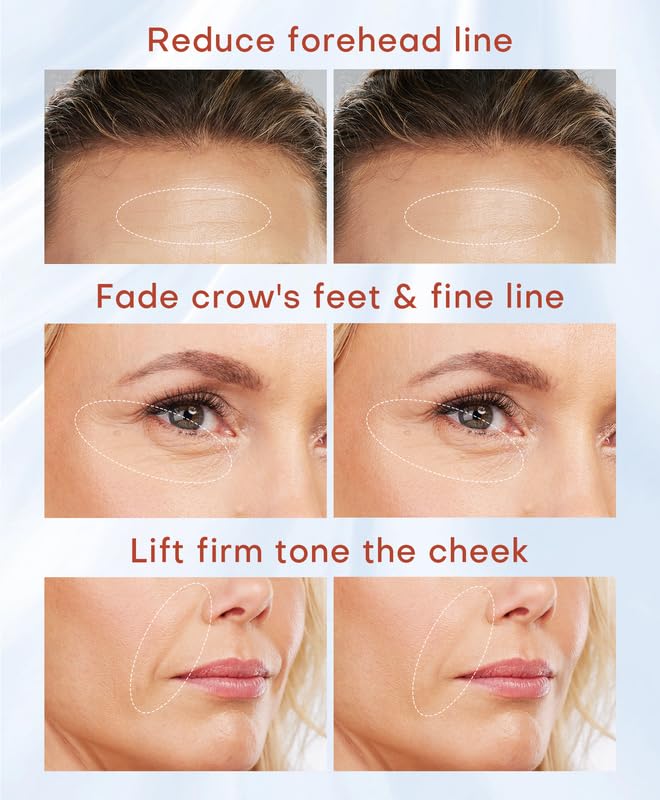 MLAY dual probes for targeted anti aging zones