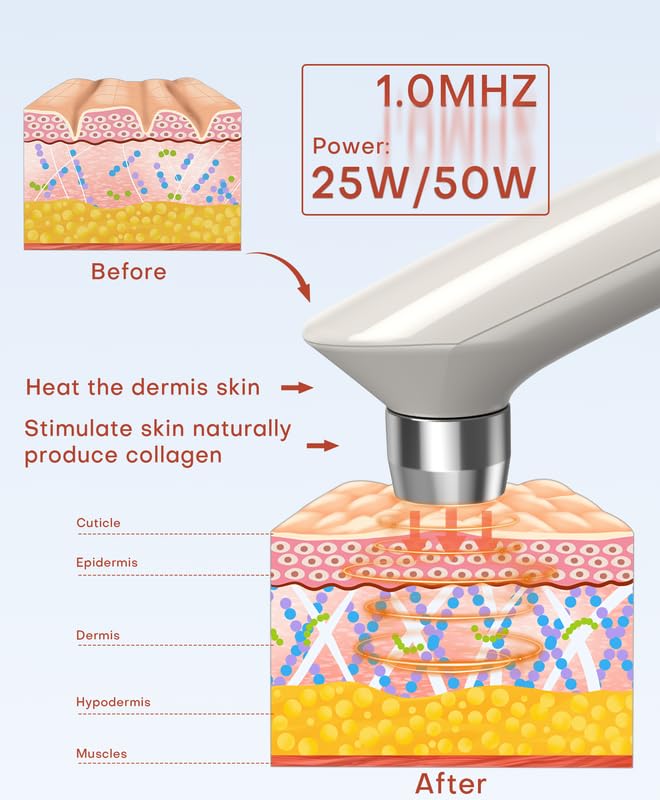 MLAY small probe 25W for eyes and delicate areas