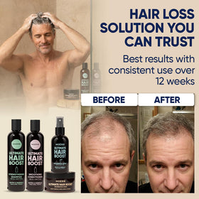 Moerie hair mask tube offering deep nourishment for thinning hair