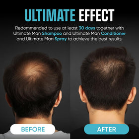 Moerie Ultimate Men Scalp Nourishment bottle emphasizes rosemary and minerals.