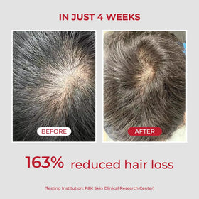 Creamy lather shown in MOEV ANNURCATIN Shampoo shot.