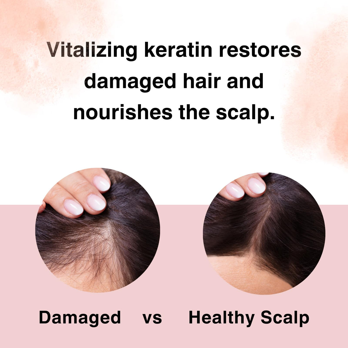 Moist Diane sulfate-free label signals gentle cleansing for scalp comfort.