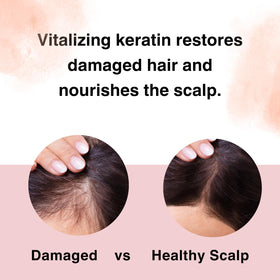 Moist Diane sulfate-free label signals gentle cleansing for scalp comfort.