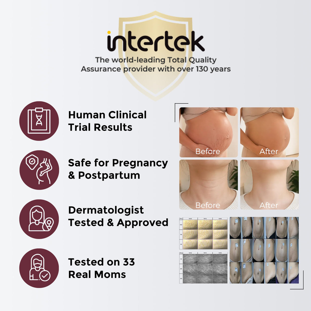 Momcozy Stretch Mark Cream postpartum-firming supports firmer-looking skin after pregnancy.