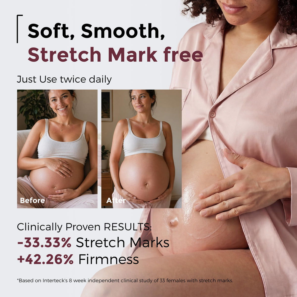 Momcozy Stretch Mark Cream pro-collagen 4x boosts elasticity for a smoother look.