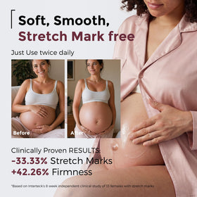 Momcozy Stretch Mark Cream pro-collagen 4x boosts elasticity for a smoother look.