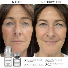 Mon Lumière hydration glow close-up highlighting plump, dewy skin