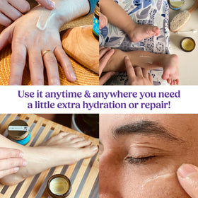 moomade balm on elbow shows hydration for dry areas