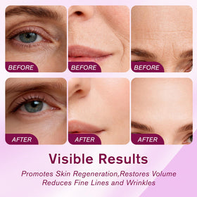 MOOMARTO Calcium Balm Stick applied on the face for gentle cheek hydration.