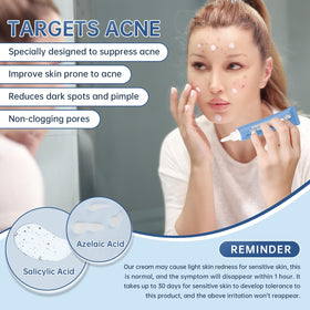 Mopayzer Azelaic Acid 14% cream label front conveys premium skincare