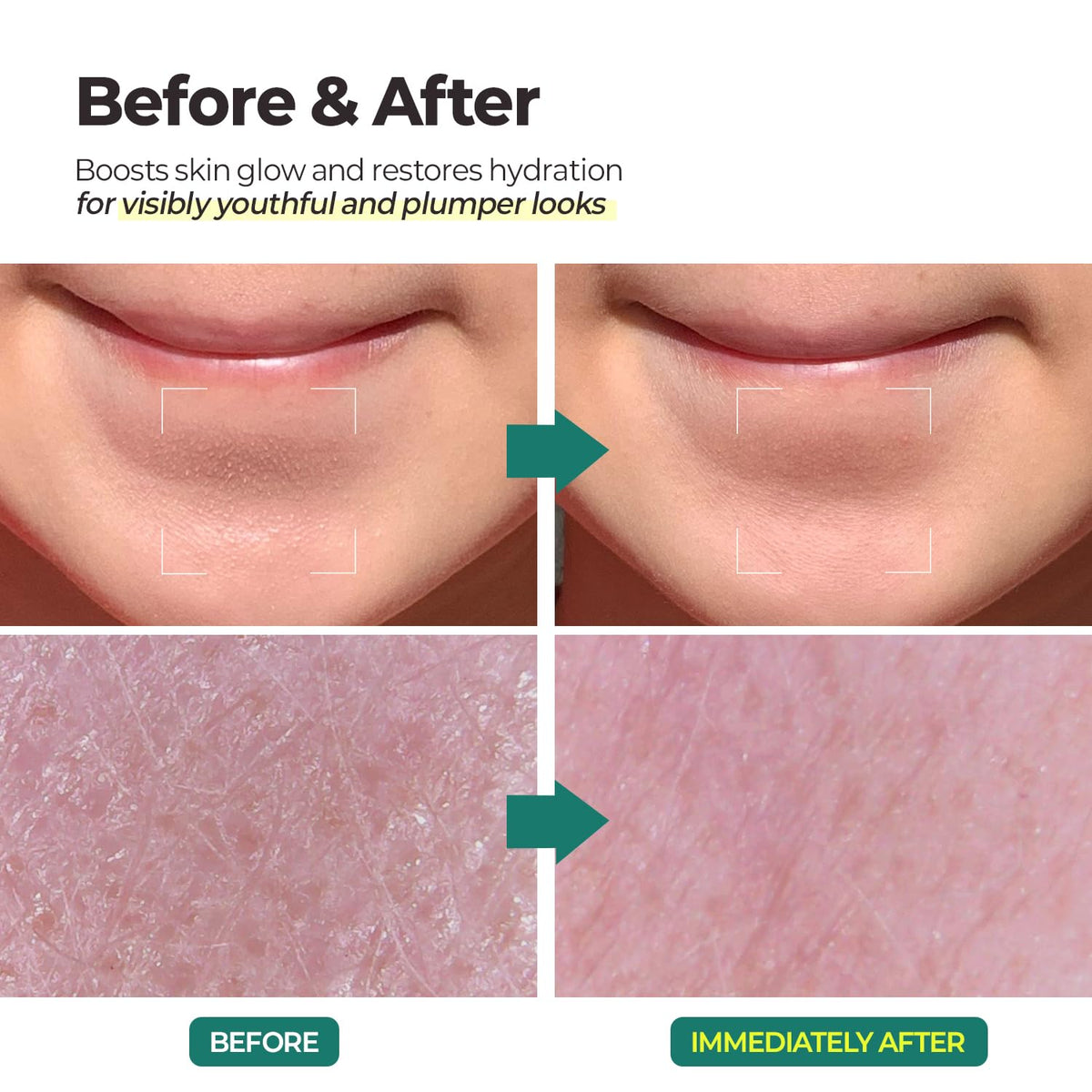 MOTHER MADE LHA pore-focused shot hints deep-clearing benefits.