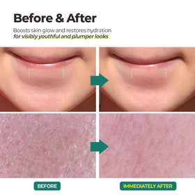 MOTHER MADE LHA pore-focused shot hints deep-clearing benefits.