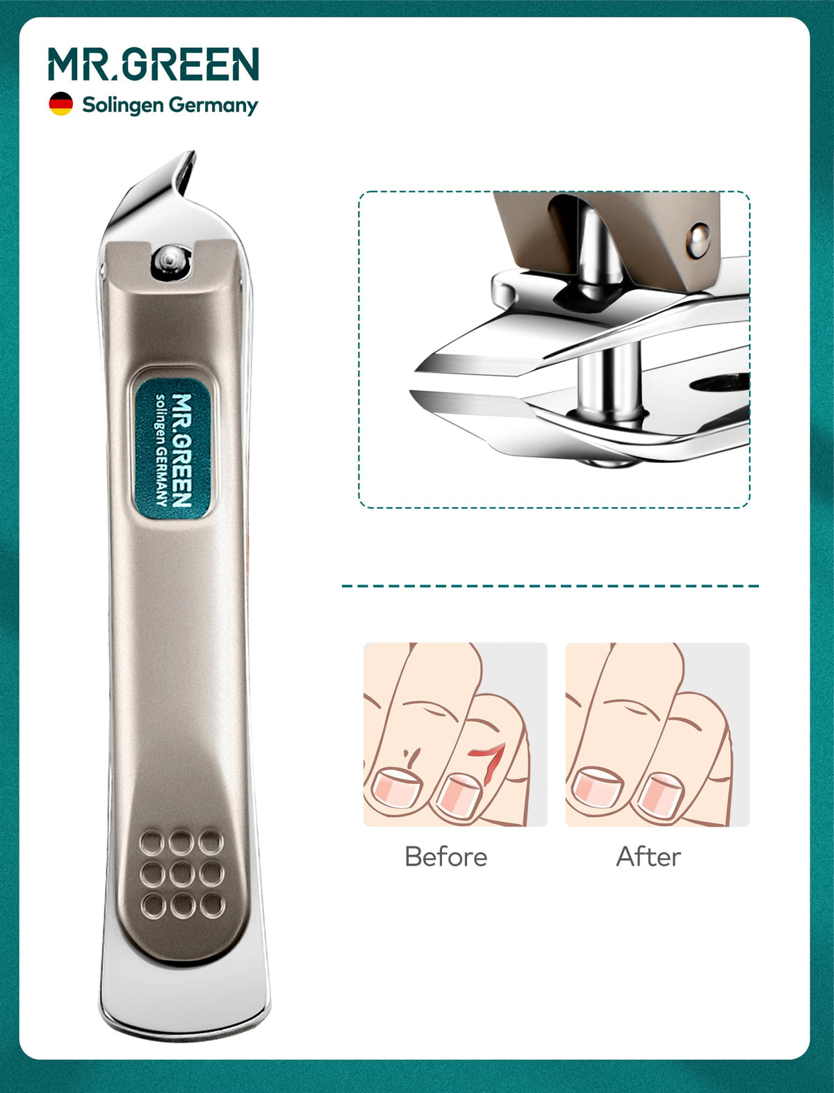 MR.GREEN tweezers close-up showing accurate grip for nail care