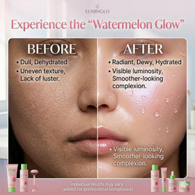 MrCuvaryas Watermelon Toner bottle refreshes and preps skin