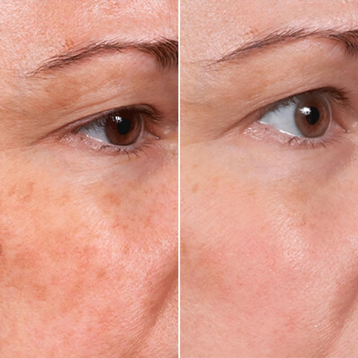 MSGBcg serum delivers hyaluronic acid for intense hydration and plump appearance.