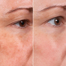 MSGBcg serum delivers hyaluronic acid for intense hydration and plump appearance.