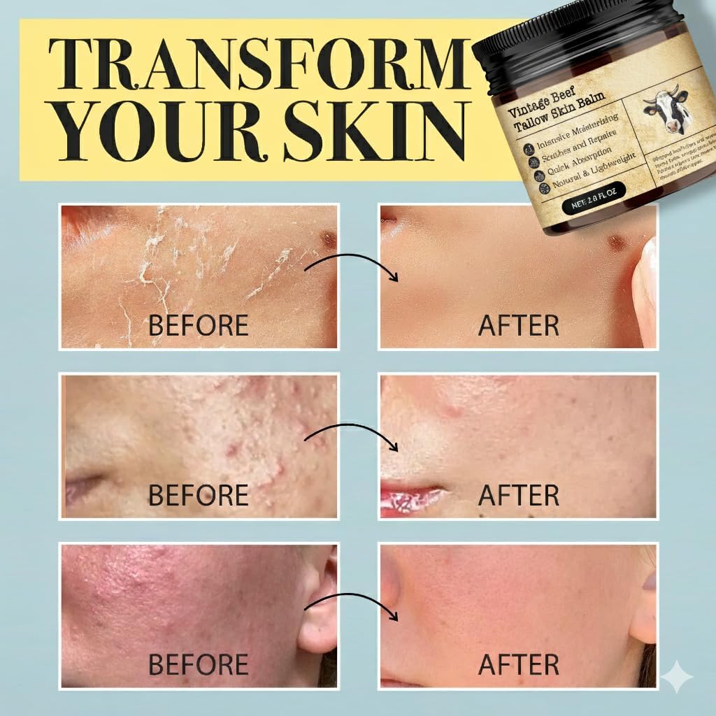 MTGBO Beef Tallow Honey Balm applied to dry hands for nourishment