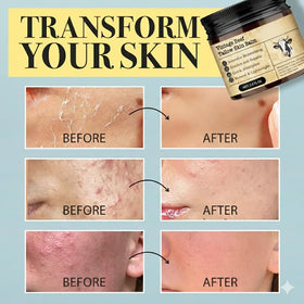 MTGBO Beef Tallow Honey Balm applied to dry hands for nourishment
