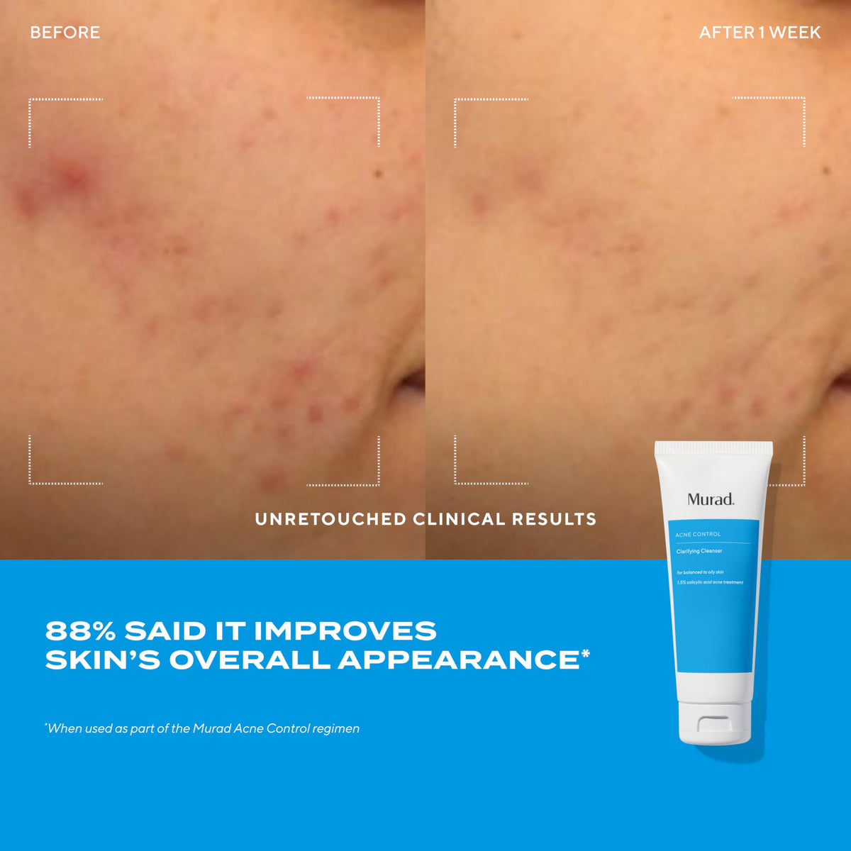 Murad Acne Trial Kit travel-case keeps your routine organized on the go