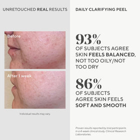 Murad Daily Clarifying Peel liquid exfoliant promotes smoother skin.