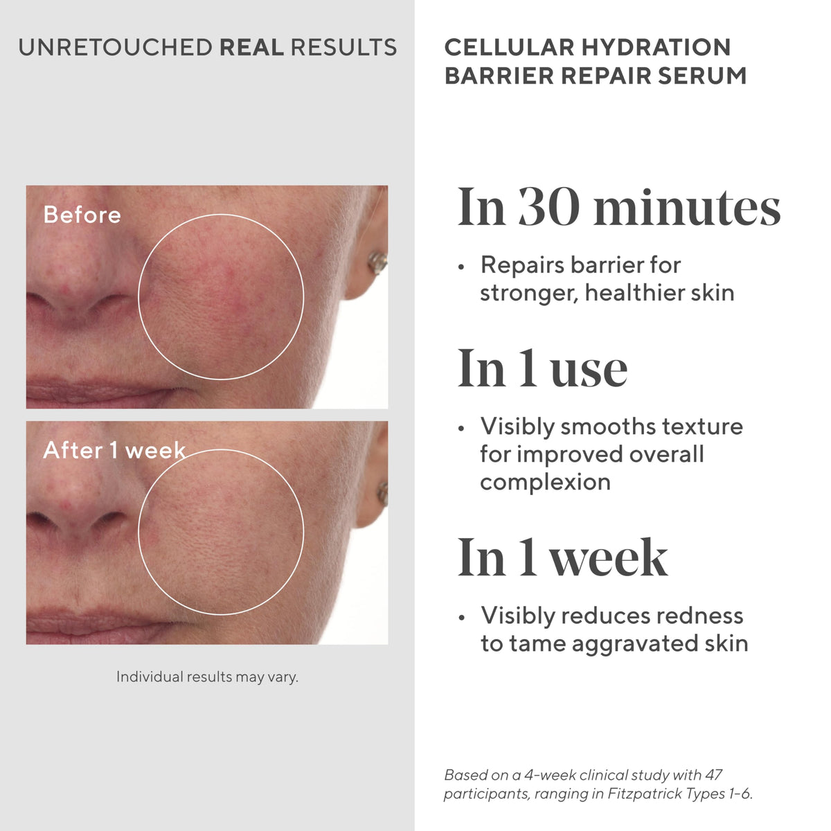 Murad Hydrate Trial Kit SPF 50 moisturizer being applied for daytime protection.