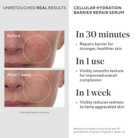 Murad Hydrate Trial Kit SPF 50 moisturizer being applied for daytime protection.