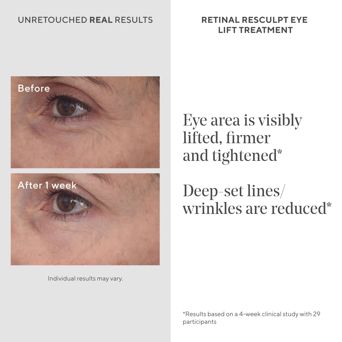 Murad Retinal ReSculpt Eye Lift cream close-up highlighting hydrating, gentle formula