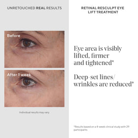 Murad Retinal ReSculpt Eye Lift cream close-up highlighting hydrating, gentle formula
