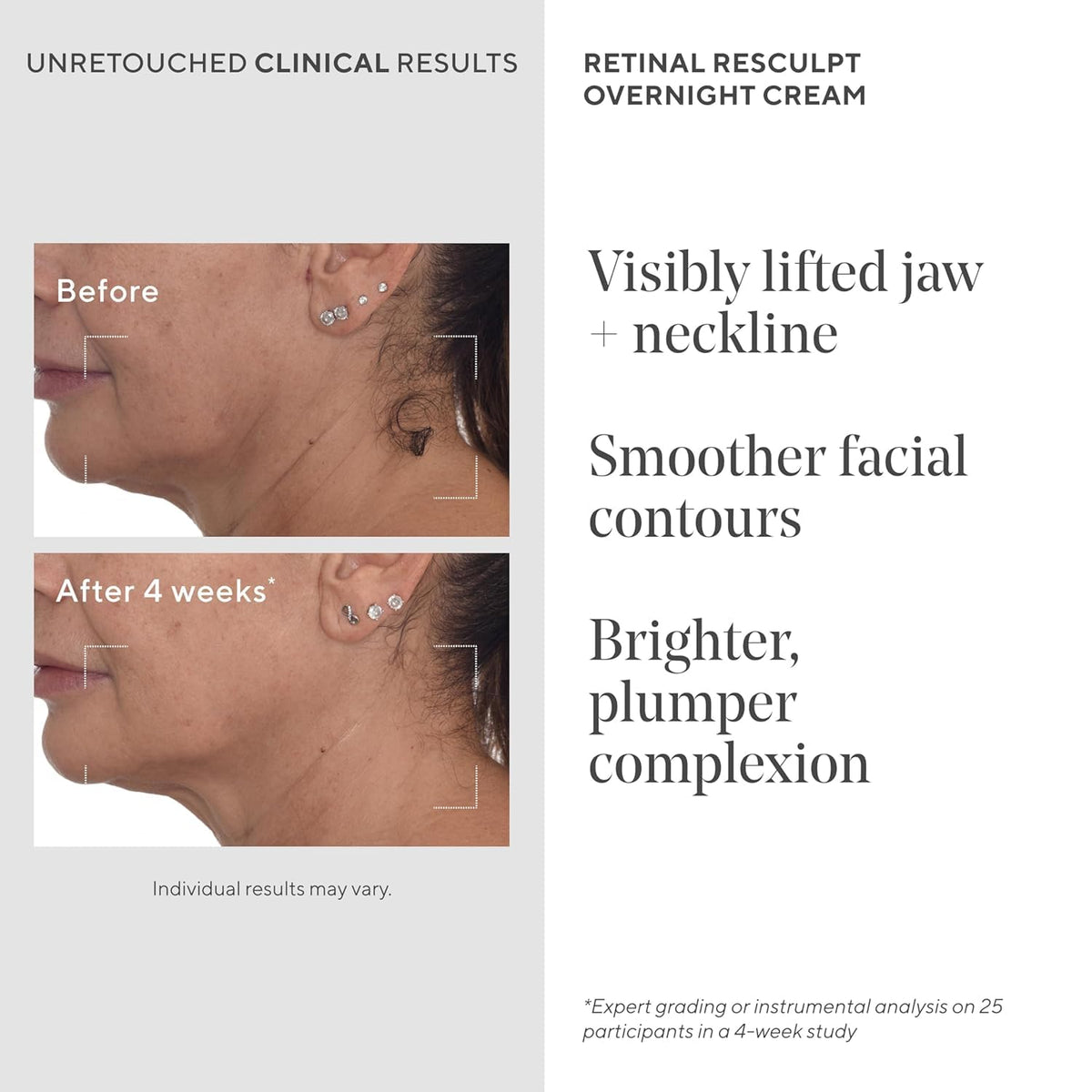 Murad Retinal ReSculpt NAD+ Lift Complex supports overnight firmness and elasticity.