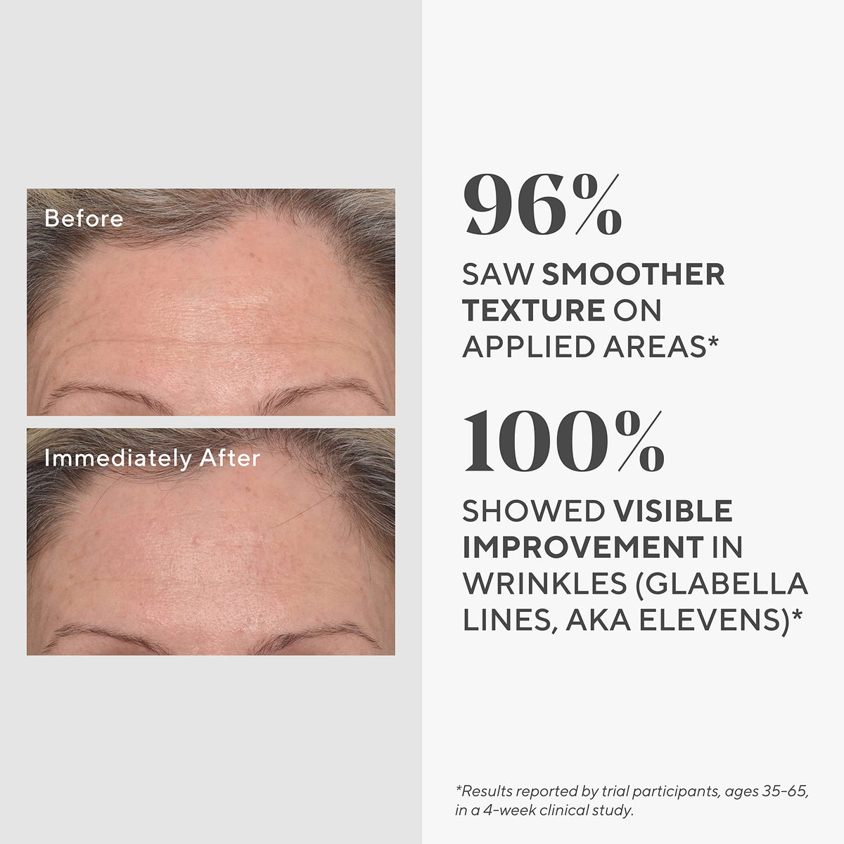 Murad Targeted Wrinkle Corrector texture swatch suggests hydrating cream for fine lines.