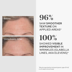 Murad Targeted Wrinkle Corrector texture swatch suggests hydrating cream for fine lines.