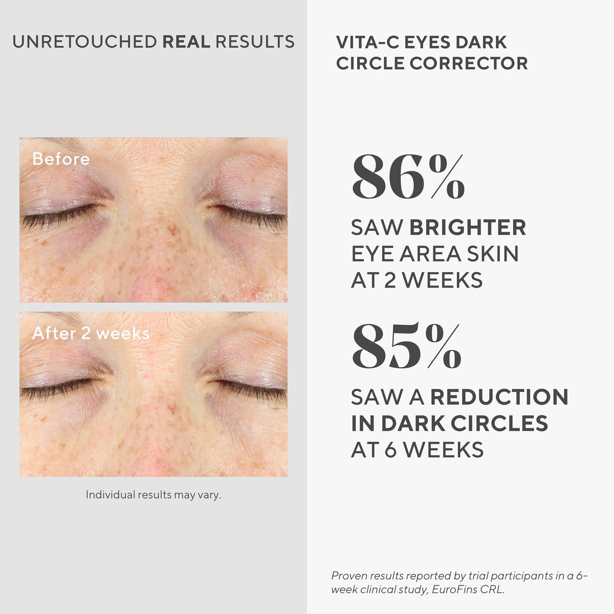 Murad Vita-C Eyes close-up texture shows silky, lightweight serum.