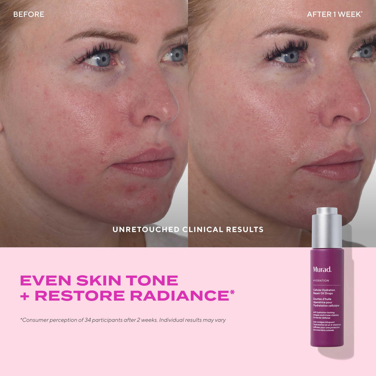 Murad Vitamin A-F antioxidant blend logo shows protective skin barrier benefits.