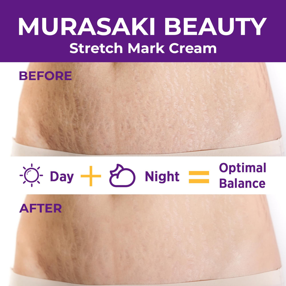 MURASAKI BEAUTY cream on thighs showing improved elasticity and smooth skin texture