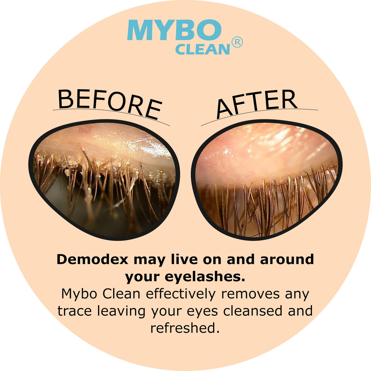 Myboclean Dead Sea Salt cleanser feature supports balanced eyelid cleansing.