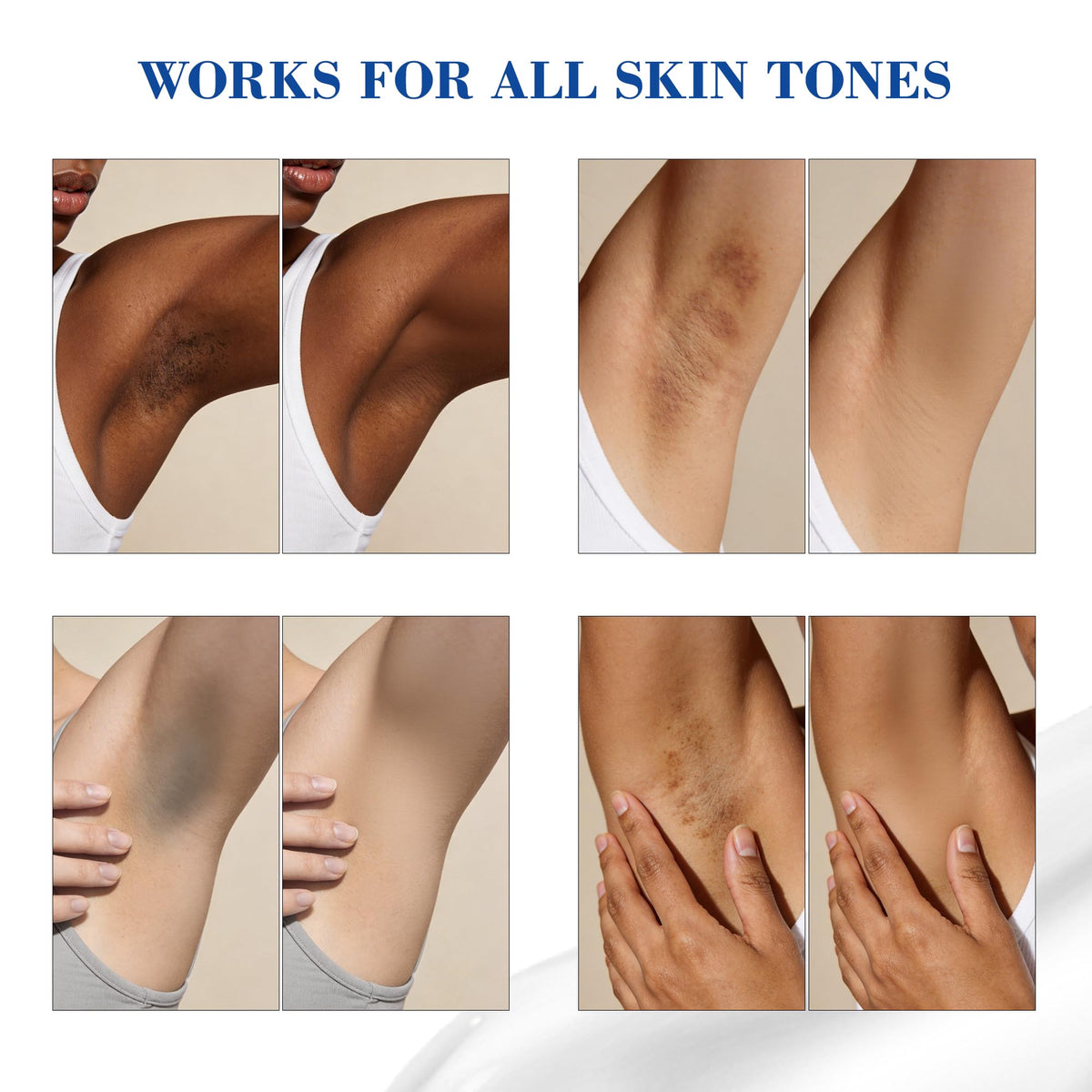 MyTend inner thigh application for even tone and hydration