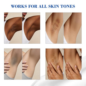 MyTend inner thigh application for even tone and hydration