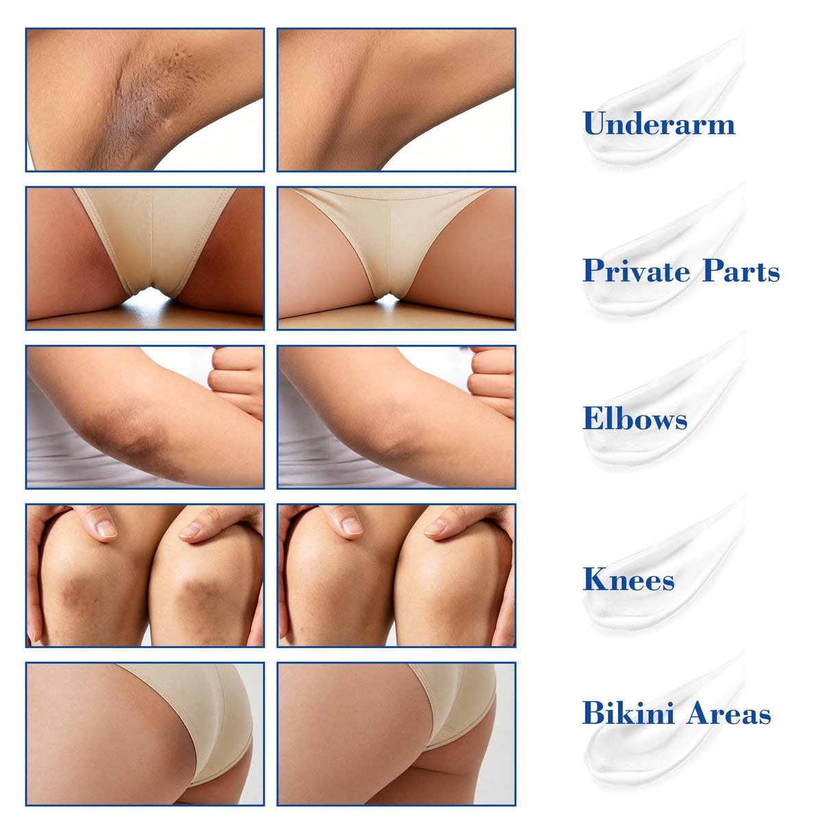 MyTend underarm application demonstrating gentle brightening for sensitive areas