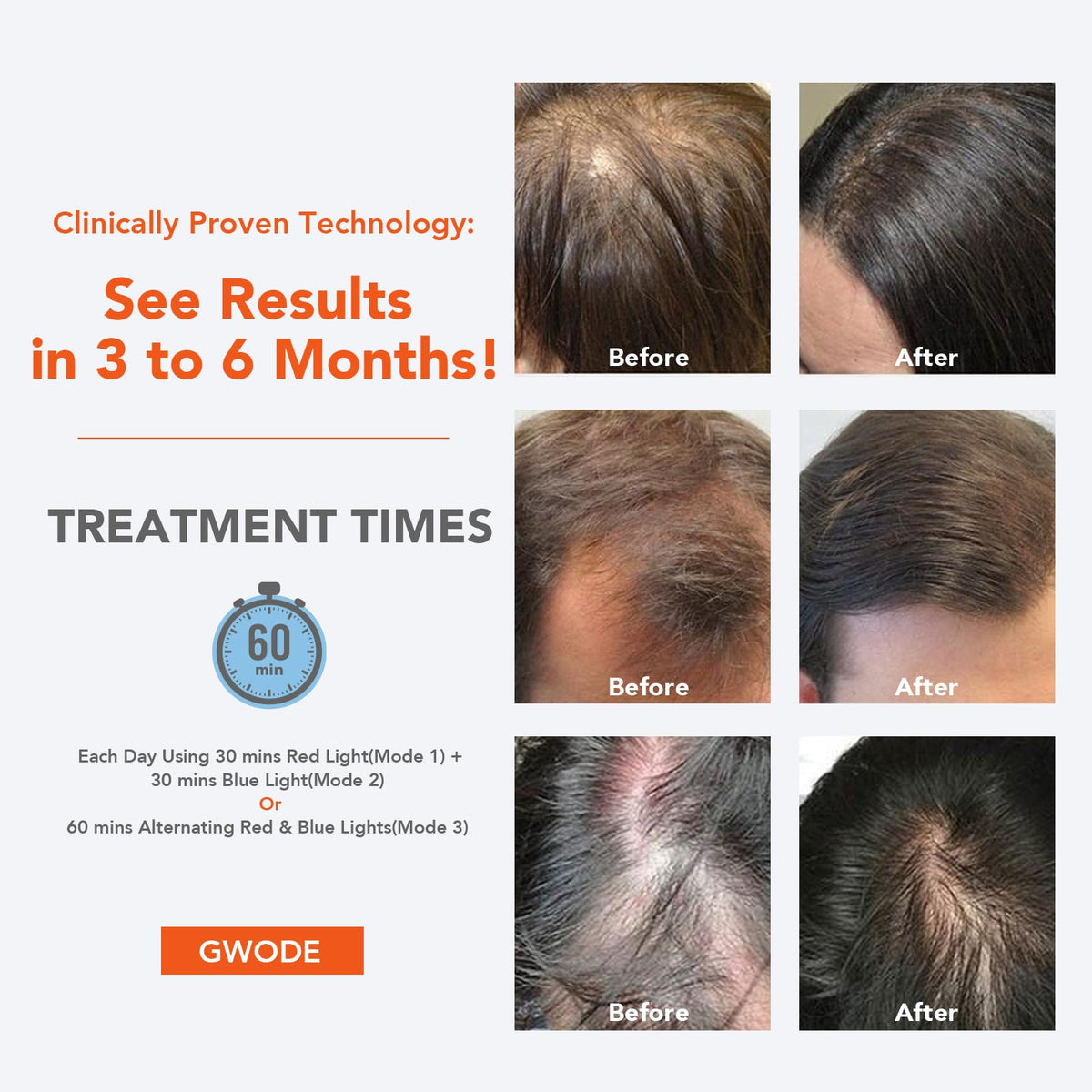 Mzong hair growth cap worn on head for convenient, cordless therapy