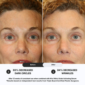 N1O1 Age-Defiance Eye Cream packaging cap and label close-up