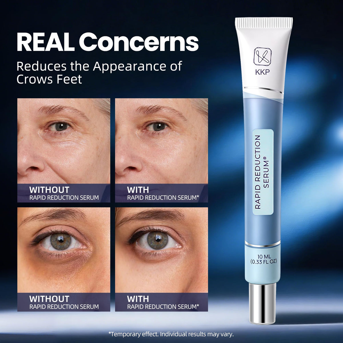 Nabevin KKP Rapid Reduction Eye Serum eye-area close-up shows smoother appearance