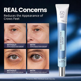 Nabevin KKP Rapid Reduction Eye Serum eye-area close-up shows smoother appearance